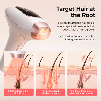 Radivex™ IPL hair removal device
