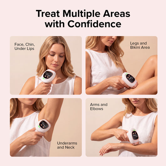Radivex™ IPL hair removal device